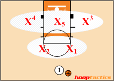 Zone Defense