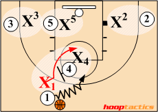 Sagging Defense