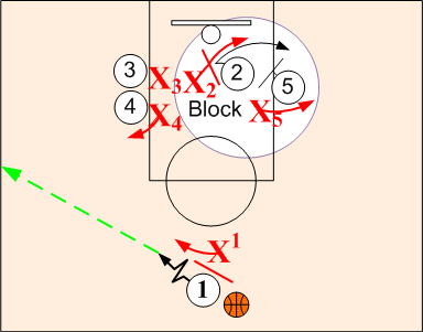 Single/Double Defensive Block