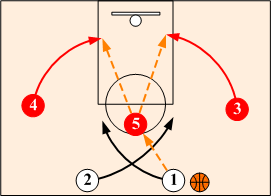 High POst Wing Back Cut Option